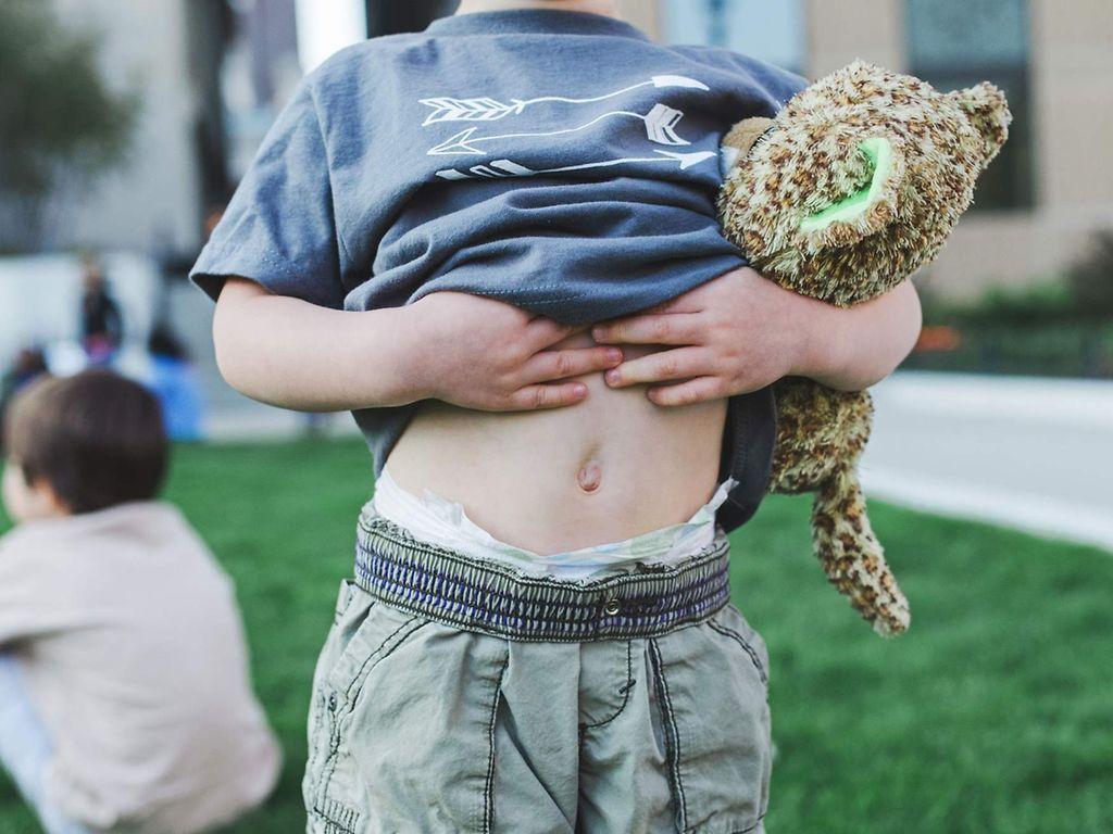 Verstopfung: Kind mit Kuscheltier im Arm zieht das T-Shirt hoch und zeigt seinen nackten Bauch.