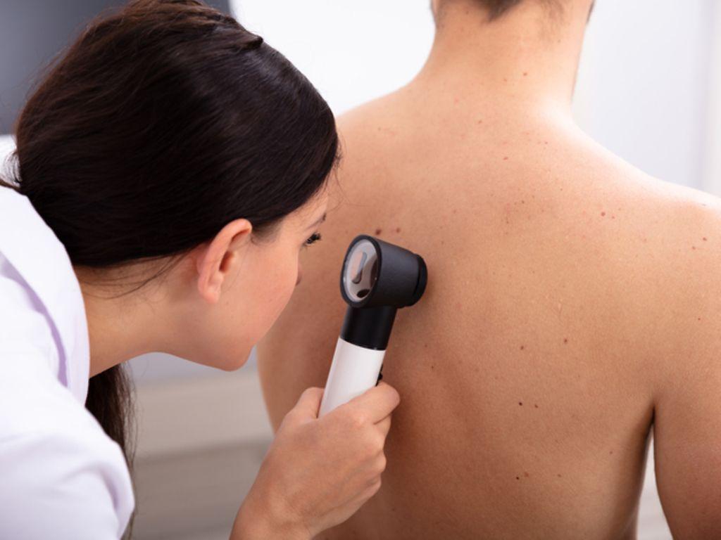 Symbolbild: Ärztin untersucht mit einem Dermatoskop die Haut eines jungen Mannes.