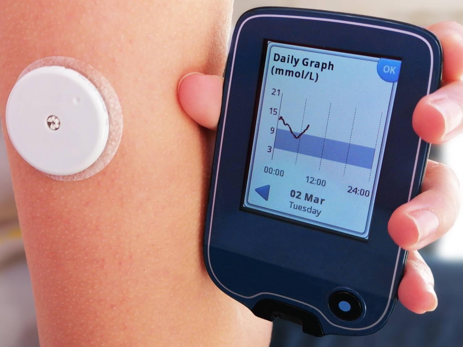 Glukosemessgeräte: Hand hält aktives Messgerät in der Hand. Daneben ist ein weißer Sensor auf dem Arm platziert.