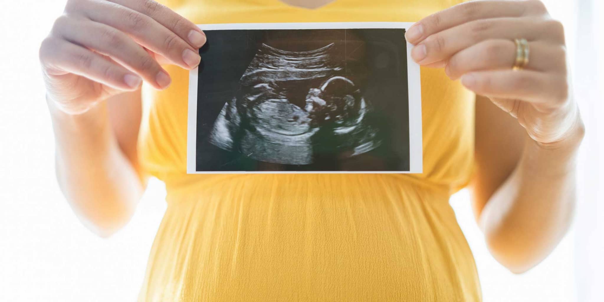 Schwangere hält Ultraschallbild